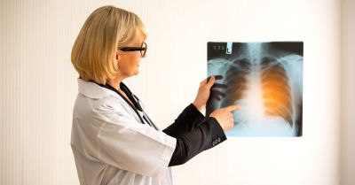 Szybsza diagnostyka raka płuca jednym z efektów działania Lung Cancer Unit